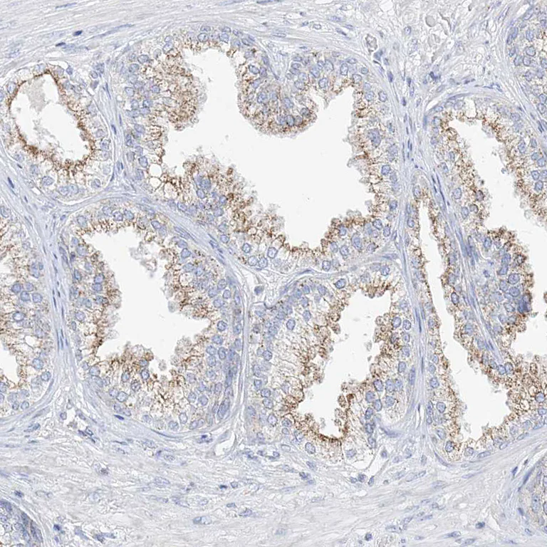 Immunohistochemistry (Formalin/PFA-fixed paraffin-embedded sections) - Anti-RASA2 antibody (AB254590)