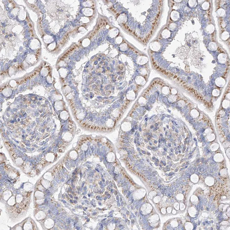 Immunohistochemistry (Formalin/PFA-fixed paraffin-embedded sections) - Anti-RASA2 antibody (AB254590)