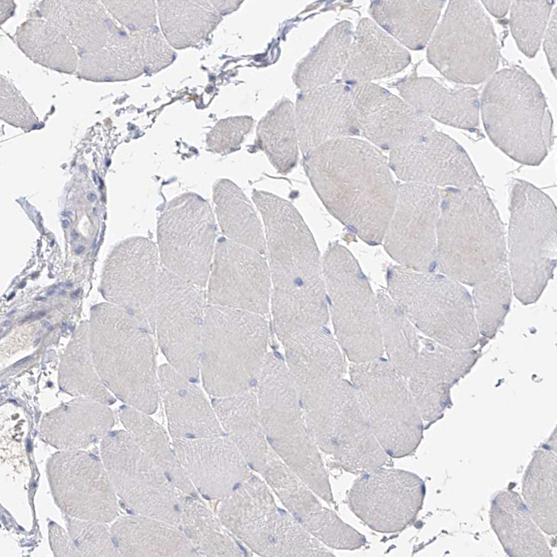 Immunohistochemistry (Formalin/PFA-fixed paraffin-embedded sections) - Anti-RASA2 antibody (AB254590)