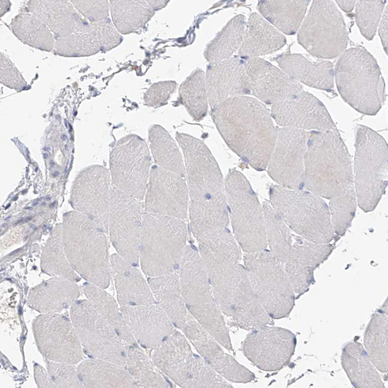 Immunohistochemistry (Formalin/PFA-fixed paraffin-embedded sections) - Anti-RASA2 antibody (AB254590)