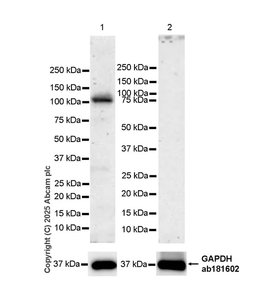 Western blot - Anti-RASA2 antibody [EPR29503-39] (AB323554)