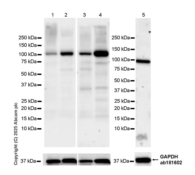 Western blot - Anti-RASA2 antibody [EPR29503-39] (AB323554)