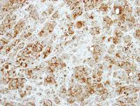 Immunohistochemistry (Formalin/PFA-fixed paraffin-embedded sections) - Anti-RASA3 antibody (AB153846)