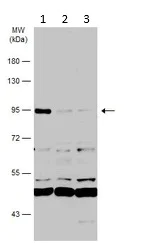 Western blot - Anti-RASA3 antibody (AB153846)