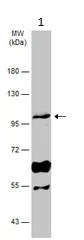 Western blot - Anti-RASA3 antibody (AB153846)