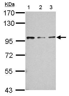 Western blot - Anti-RASA4 antibody (AB151232), expandable thumbnail