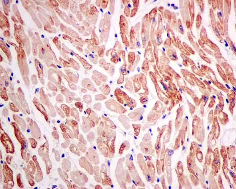 Immunohistochemistry (Formalin/PFA-fixed paraffin-embedded sections) - Anti-RASA4 antibody [EPR10515] (AB157190), expandable thumbnail