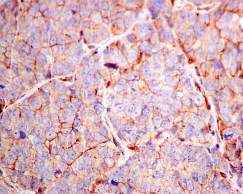 Immunohistochemistry (Formalin/PFA-fixed paraffin-embedded sections) - Anti-RASA4 antibody [EPR10515] (AB157190), expandable thumbnail