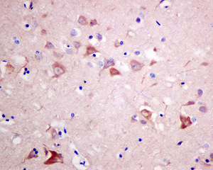 Immunohistochemistry (Formalin/PFA-fixed paraffin-embedded sections) - Anti-RASA4 antibody [EPR10515] (ab157190), expandable thumbnail