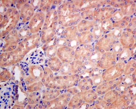Immunohistochemistry (Formalin/PFA-fixed paraffin-embedded sections) - Anti-RASA4 antibody [EPR10515] (AB157190), expandable thumbnail