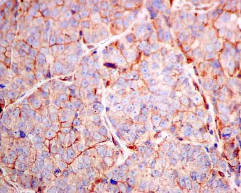 Immunohistochemistry (Formalin/PFA-fixed paraffin-embedded sections) - Anti-RASA4 antibody [EPR10515] - BSA and Azide free (AB249298)