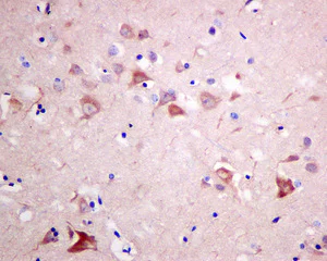 Immunohistochemistry (Formalin/PFA-fixed paraffin-embedded sections) - Anti-RASA4 antibody [EPR10515] - BSA and Azide free (AB249298)