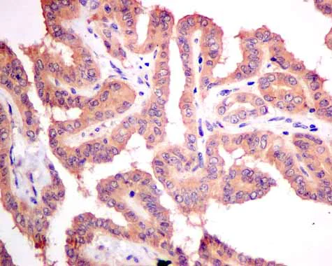 Immunohistochemistry (Formalin/PFA-fixed paraffin-embedded sections) - Anti-RASA4 antibody [EPR10515] - BSA and Azide free (AB249298)
