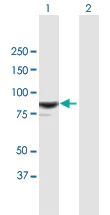Western blot - Anti-RASAL1 antibody (AB168610)