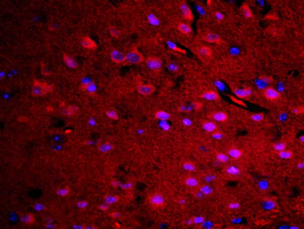 Immunohistochemistry (Formalin/PFA-fixed paraffin-embedded sections) - Anti-RASAL1 antibody (AB214321)