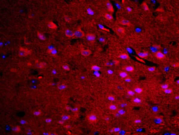 Immunohistochemistry (Formalin/PFA-fixed paraffin-embedded sections) - Anti-RASAL1 antibody (AB214321)