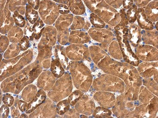 Immunohistochemistry (Formalin/PFA-fixed paraffin-embedded sections) - Anti-RASGEF1A antibody (AB229272)