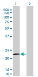 Western blot - Anti-RASGEF1B antibody (AB168323), expandable thumbnail