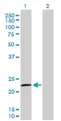 Western blot - Anti-RASGEF1B antibody (AB168323)