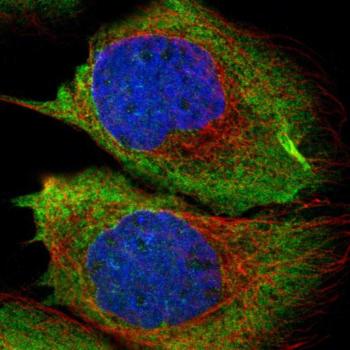 Immunocytochemistry/ Immunofluorescence - Anti-RASGRF2 antibody (ab121577), expandable thumbnail