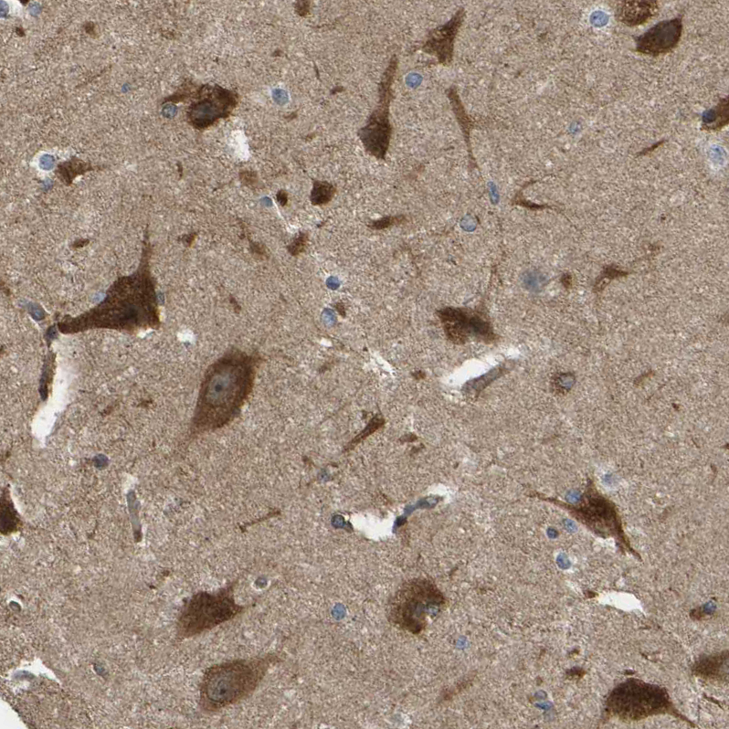Immunohistochemistry (Formalin/PFA-fixed paraffin-embedded sections) - Anti-RASGRF2 antibody (AB121577), expandable thumbnail