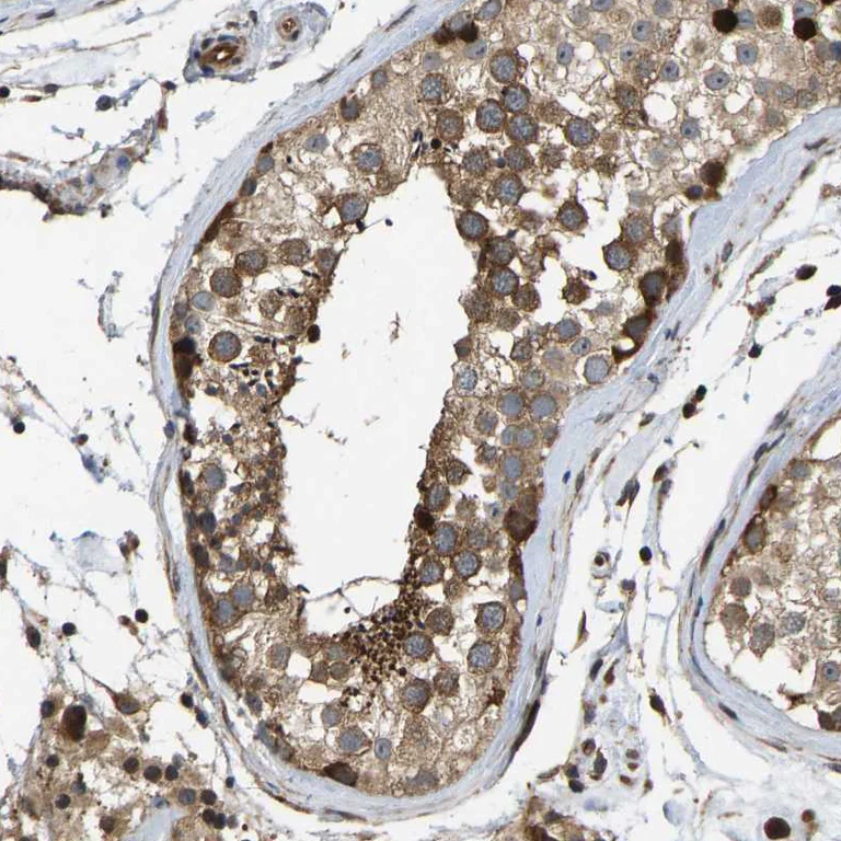 Immunohistochemistry (Formalin/PFA-fixed paraffin-embedded sections) - Anti-RASGRF2 antibody (AB121577)