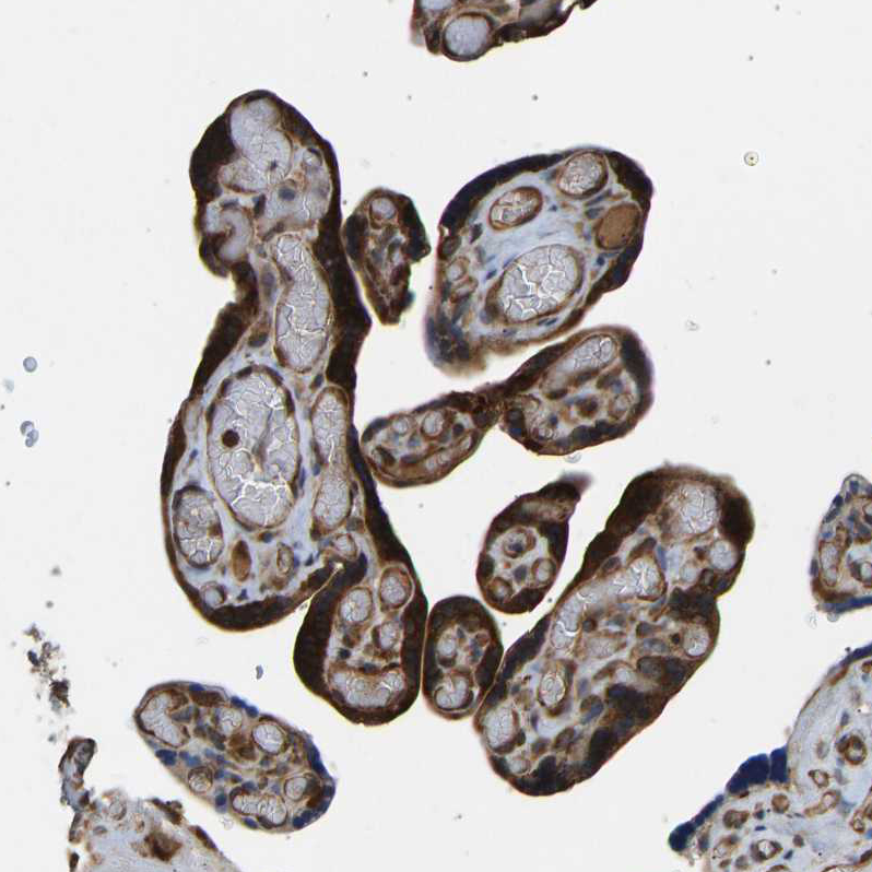 Immunohistochemistry (Formalin/PFA-fixed paraffin-embedded sections) - Anti-RASGRF2 antibody (AB121577), expandable thumbnail