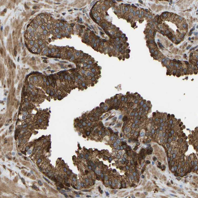 Immunohistochemistry (Formalin/PFA-fixed paraffin-embedded sections) - Anti-RASGRF2 antibody (AB121577)