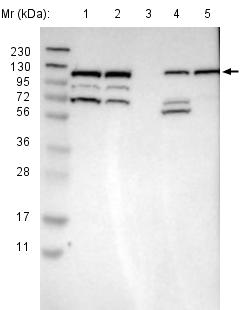 Western blot - Anti-RASGRF2 antibody (AB121577), expandable thumbnail