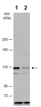 Western blot - Anti-RASGRF2 antibody - C-terminal (AB226973)