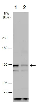 Western blot - Anti-RASGRF2 antibody - C-terminal (AB226973)