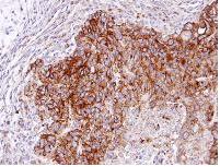 Immunohistochemistry (Formalin/PFA-fixed paraffin-embedded sections) - Anti-RASGRP 4 antibody (AB96293)