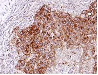 Immunohistochemistry (Formalin/PFA-fixed paraffin-embedded sections) - Anti-RASGRP 4 antibody (AB96293)