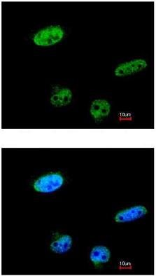 Immunocytochemistry/ Immunofluorescence - Anti-RASSF1 antibody (AB97749), expandable thumbnail