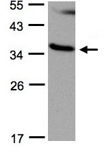 Western blot - Anti-RASSF1 antibody (AB97749), expandable thumbnail