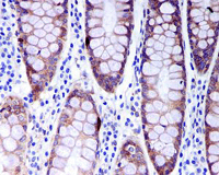 Immunohistochemistry (Formalin/PFA-fixed paraffin-embedded sections) - Anti-RASSF1 antibody [EPR7127] - BSA and Azide free (AB248174)
