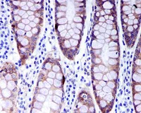 Immunohistochemistry (Formalin/PFA-fixed paraffin-embedded sections) - Anti-RASSF1 antibody [EPR7127] - BSA and Azide free (AB248174)