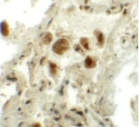 Immunohistochemistry (Formalin/PFA-fixed paraffin-embedded sections) - Anti-RASSF10 antibody (AB113105)