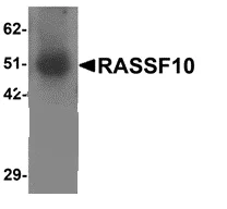 Western blot - Anti-RASSF10 antibody (AB113105)