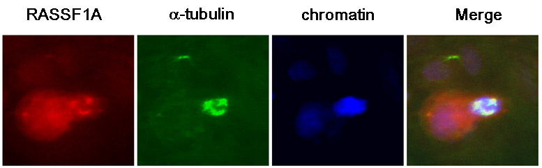 Immunocytochemistry/ Immunofluorescence - Anti-RASSF1a antibody [3F3] (AB23950)