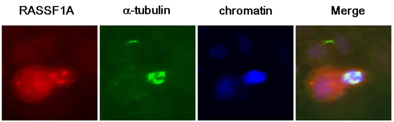 Immunocytochemistry/ Immunofluorescence - Anti-RASSF1a antibody [3F3] (AB23950)