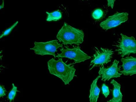 Immunocytochemistry/ Immunofluorescence - Anti-RASSF1a antibody [3F3] (AB23950)