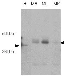 Western blot - Anti-RASSF1a antibody [3F3] (AB23950)