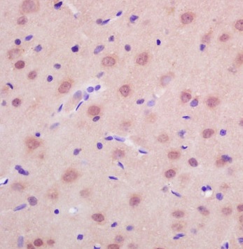 Immunohistochemistry (Formalin/PFA-fixed paraffin-embedded sections) - Anti-RASSF2 antibody (AB203580), expandable thumbnail