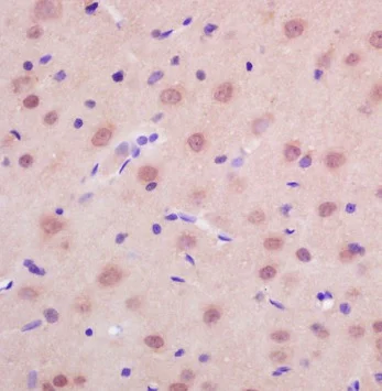 Immunohistochemistry (Formalin/PFA-fixed paraffin-embedded sections) - Anti-RASSF2 antibody (AB203580)