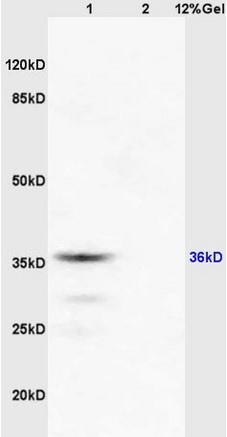 Western blot - Anti-RASSF2 antibody (AB203580), expandable thumbnail