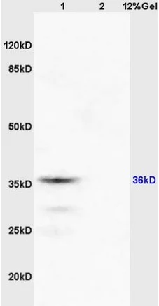Western blot - Anti-RASSF2 antibody (AB203580)