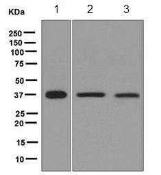 Western blot - Anti-RASSF2 antibody [EPR6621] (AB124786)