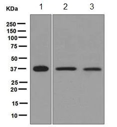 Western blot - Anti-RASSF2 antibody [EPR6621] (AB124786)
