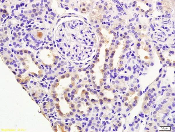 Immunohistochemistry (Formalin/PFA-fixed paraffin-embedded sections) - Anti-RASSF3 antibody (AB204117)